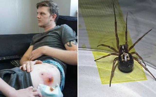 Após picada de aranha, homem fica dois meses sem andar