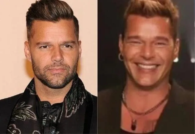 Ricky Martin se explica após aparecer com rosto bem diferente em entrevista