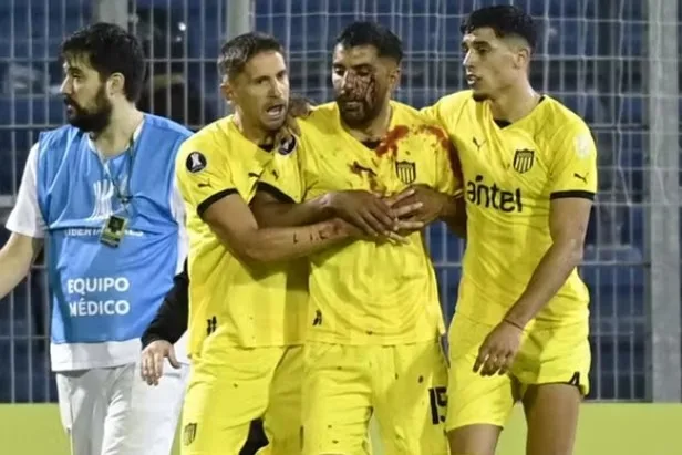 VÍDEO | Torcida argentina atira pedra em jogador adversário na Libertadores