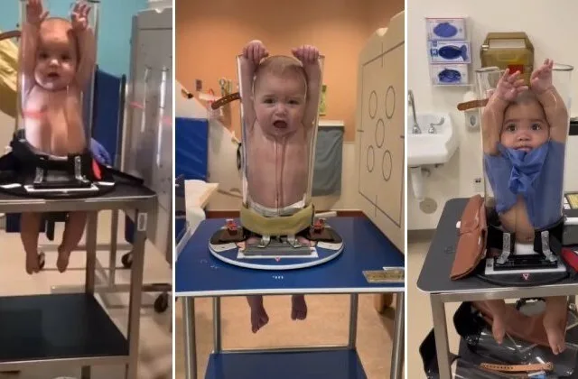 Vídeos de bebês em aparelho de raio-X viralizam. Assista