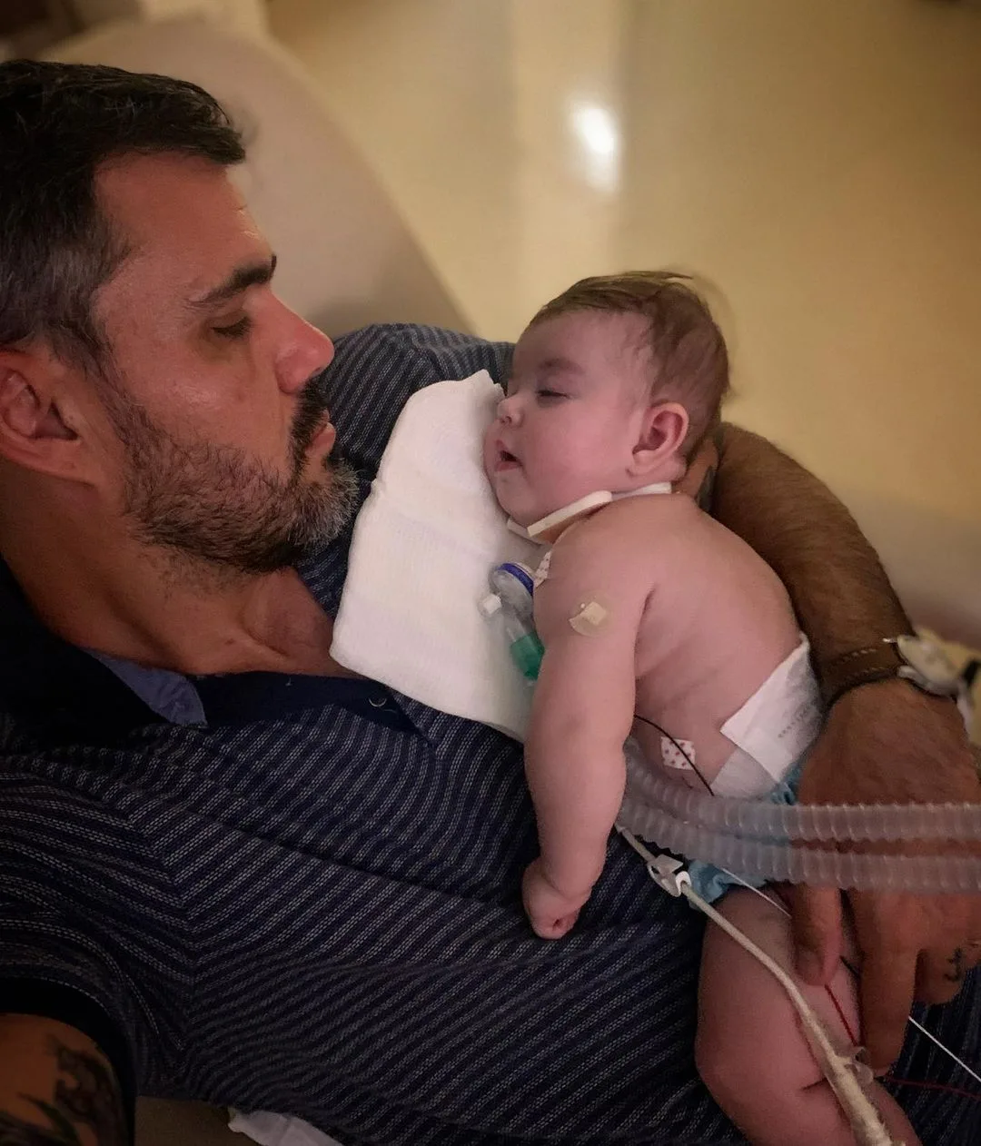 Filha caçula do ator Juliano Cazarré passa por nova cirurgia