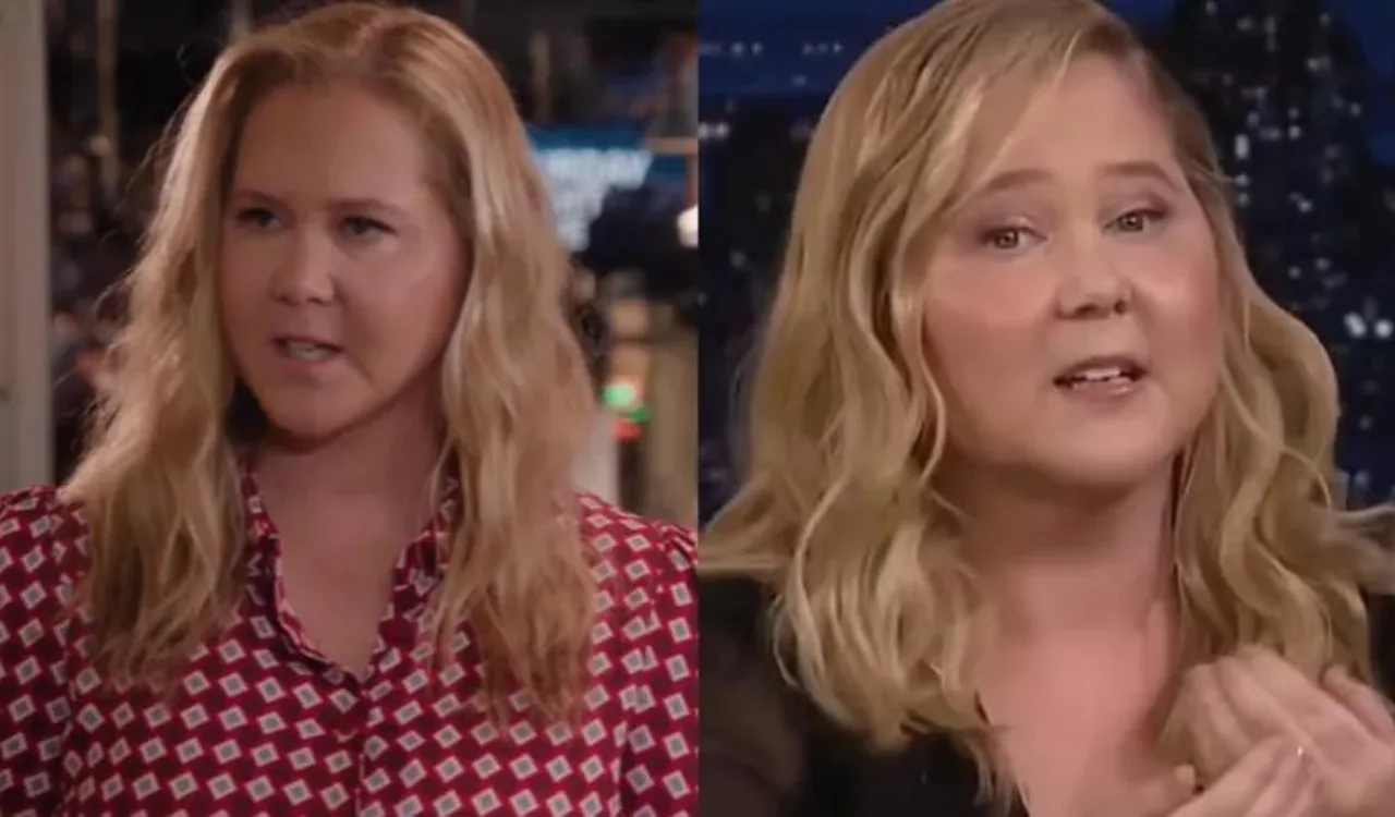 Amy Schumer revela diagnóstico de síndrome de Cushing após fãs questionarem rosto inchado