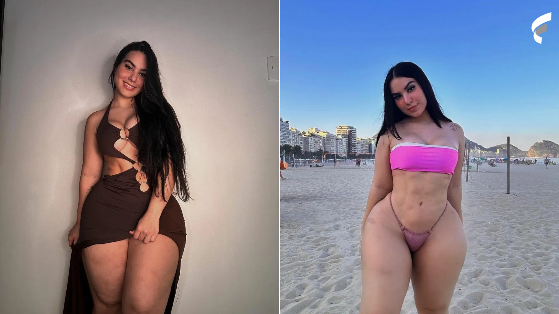 Influencer com lipedema desabafa doença: “Necessidade de maior inclusão”