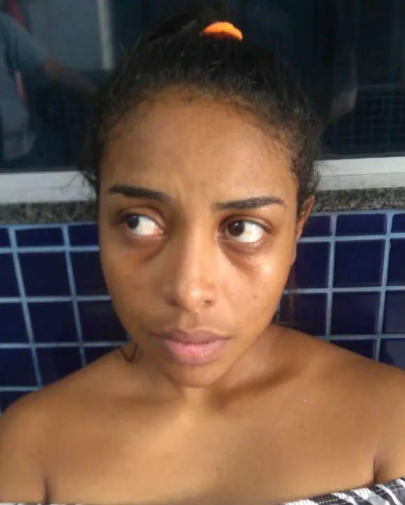 Grávida, mulher presa com drogas passa mal durante ocorrência em Vila Velha