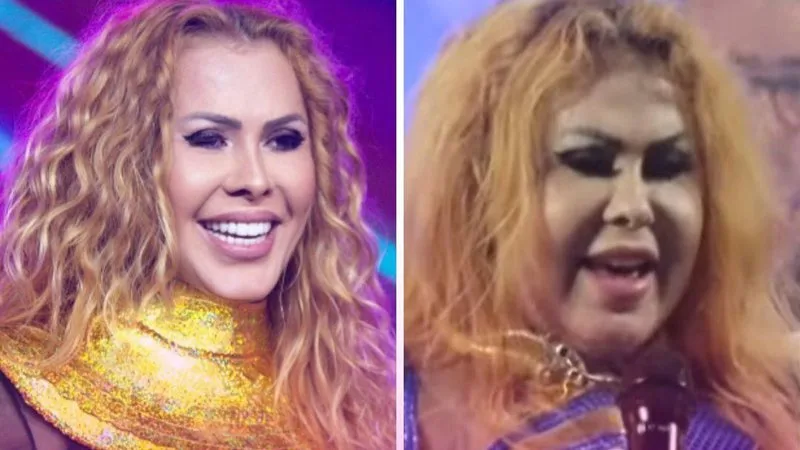 Joelma é internada e faz exames após inchaço anormal no rosto