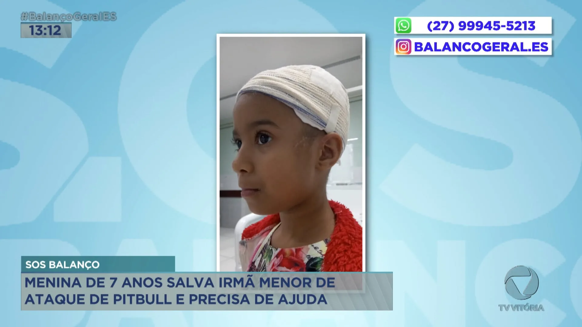 Menina de 7 anos que sofreu ataque de Pitbull precisa de ajuda