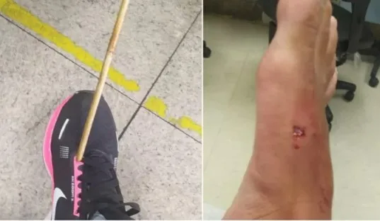 Mulher é atingida por “flecha” enquanto caminhava em rua de BH