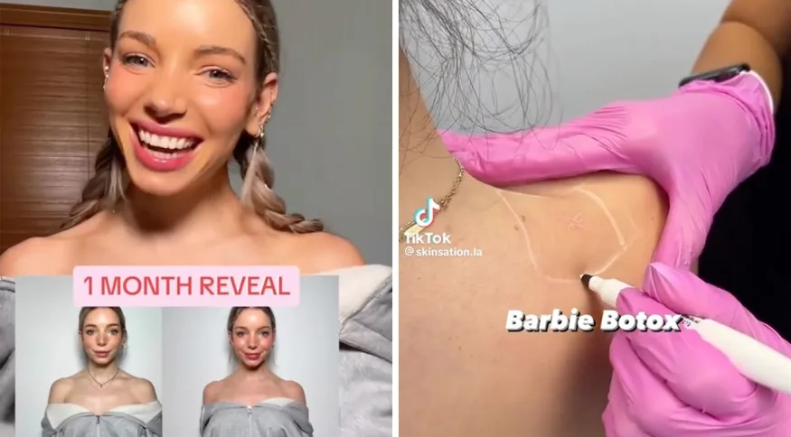 Viralizou: o que é Botox da Barbie do TikTok, novo "perigo" da beleza