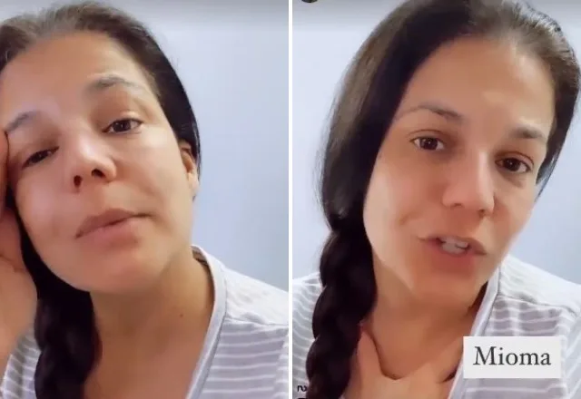 Nivea Stelmann relata sangramento e cirurgia de emergência no útero