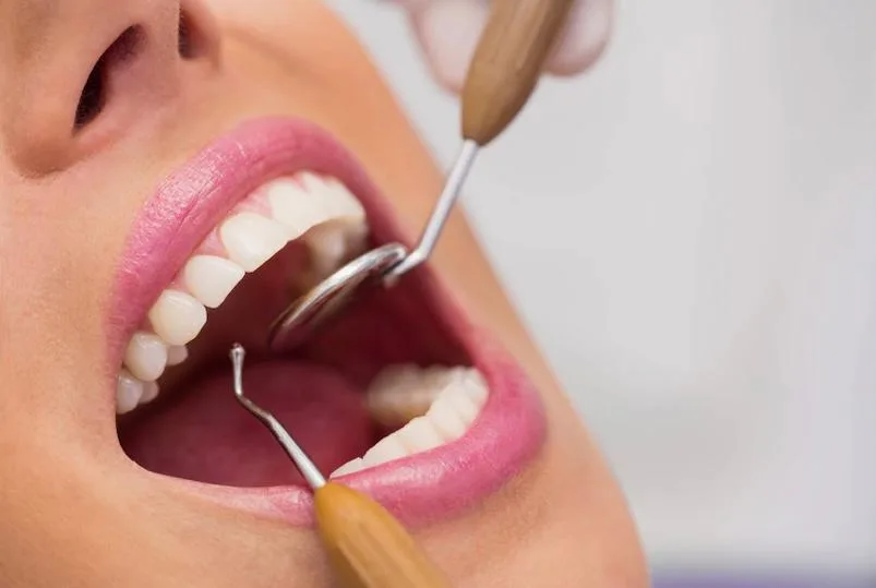 Dentes a mais: é normal ter? Entenda