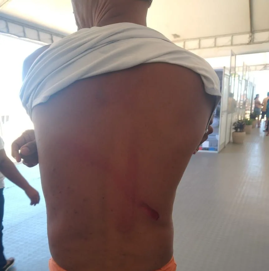 VÍDEO | Homem é agredido com chicote após reclamar de cavalo na Praia de Itapoã, em Vila Velha