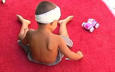 Criança de dois anos é atingida por pedrada durante discussão de familiares na Serra