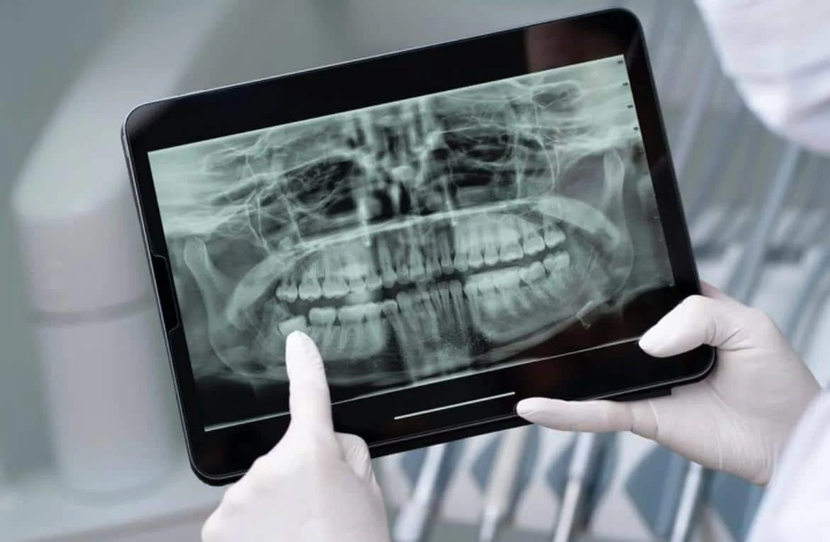 Radiografias odontológicas: com que frequência devo fazer?