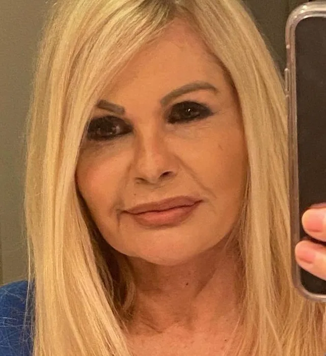 Aos 64 anos, Monique Evans mostra resultado de harmonização facial sem filtro e choca internautas