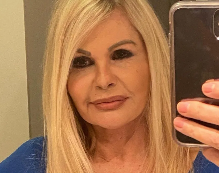 Aos 64 anos, Monique Evans mostra resultado de harmonização facial sem filtro e choca internautas