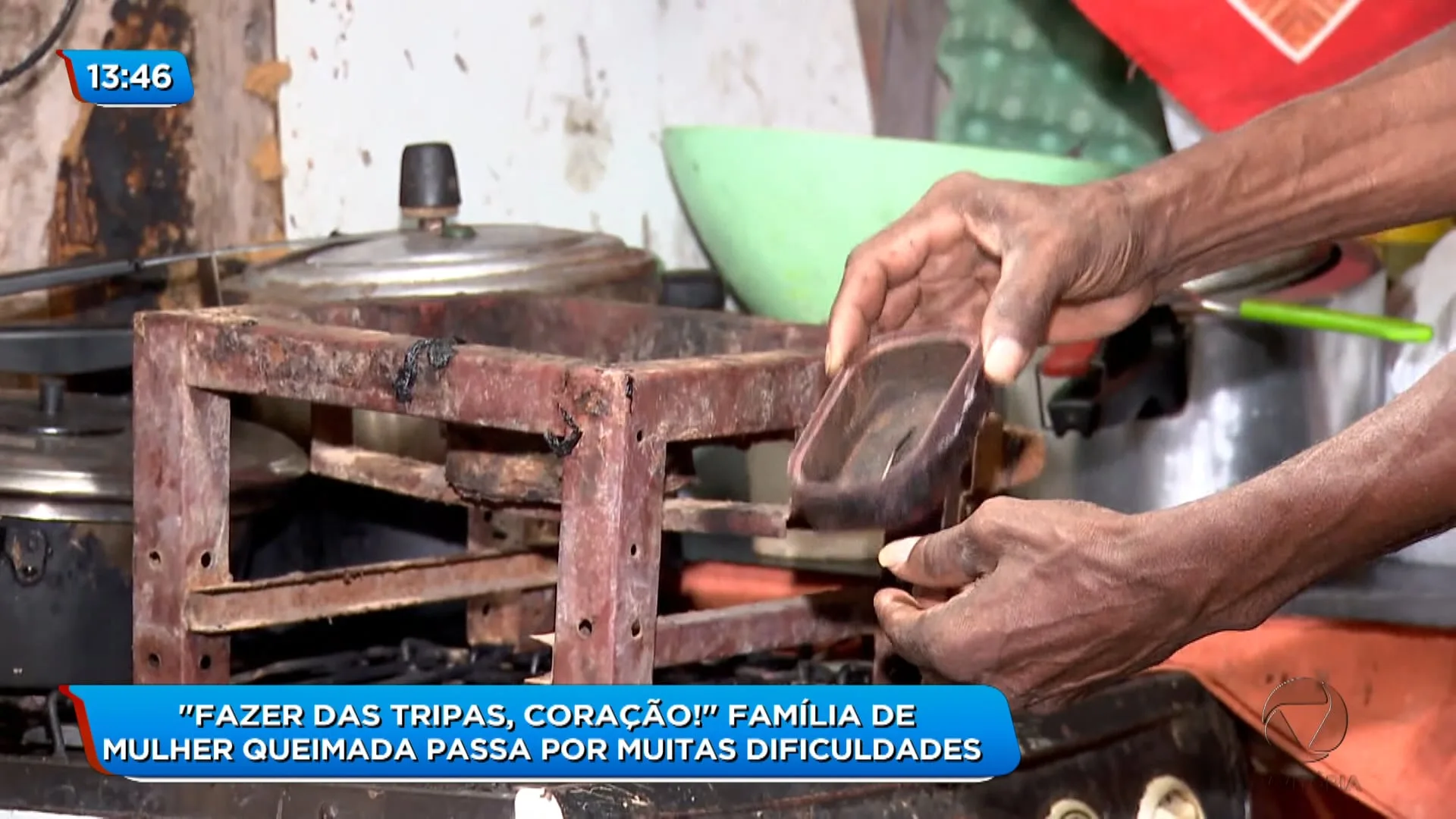 Família de mulher queimada ao cozinhar com etanol passa dificuldades