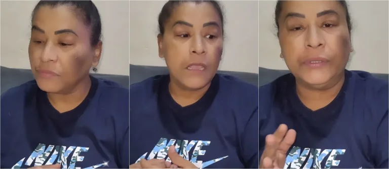 Cantora corre risco de perder parte do pé após passar por cirurgia para retirar tumor