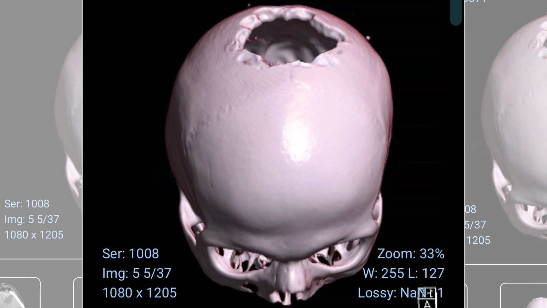 xr:d:DAFculB74CU:59,j:4501759806551846697,t:23121117