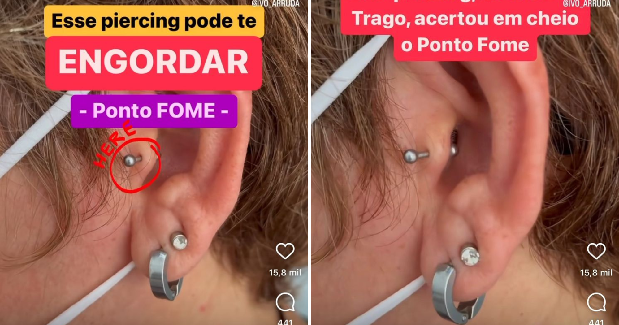 Vídeo de "piercing que engorda" viraliza e gera alerta: "Fome"