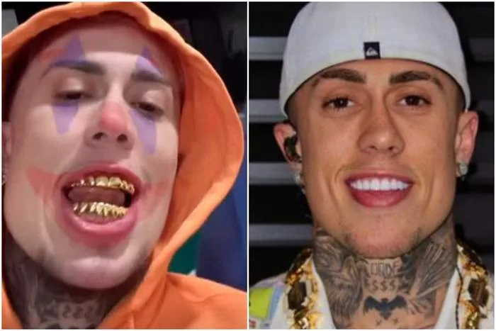 Quanto custa a prótese de ouro que MC Daniel colocou nos dentes?