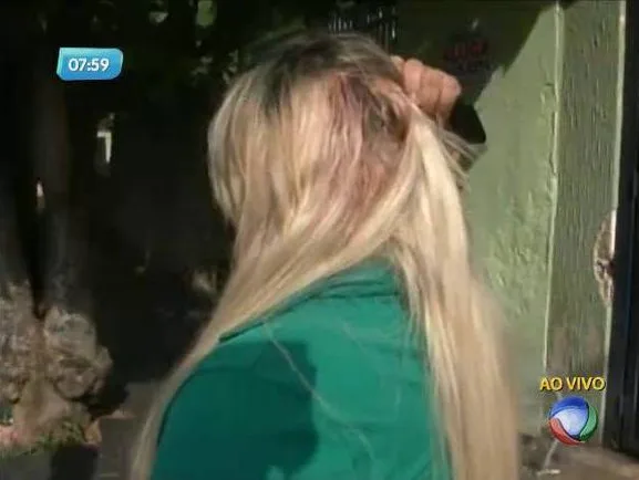 Mulher leva martelada de ex na cabeça e é salva por aplique de cabelo