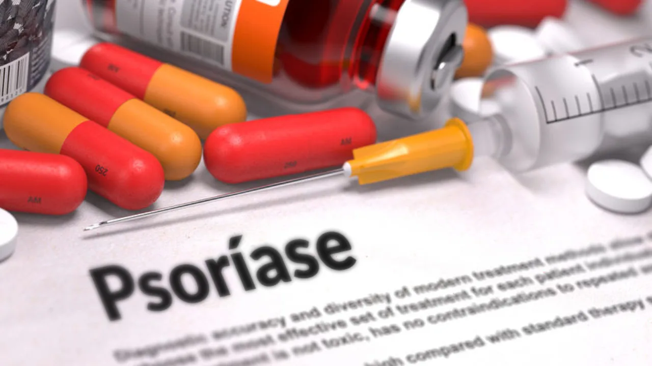 Psoriasis – Printed Diagnosis with Blurred Text. On Background of Medicaments Composition – Red Pills, Injections and Syringe.