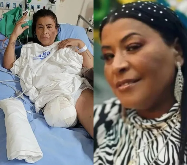 Morte de MC Katia: entenda doença que causou amputação de perna e sintomas