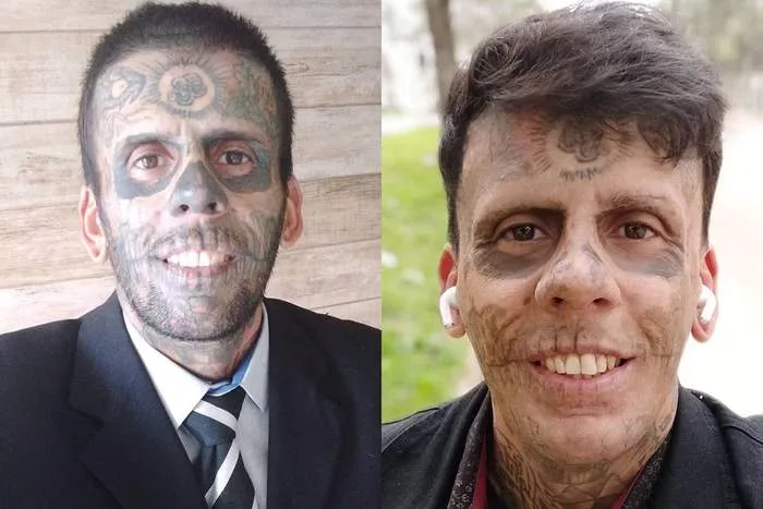 Homem mais tatuado do Brasil entra para igreja evangélica e remove tatuagens