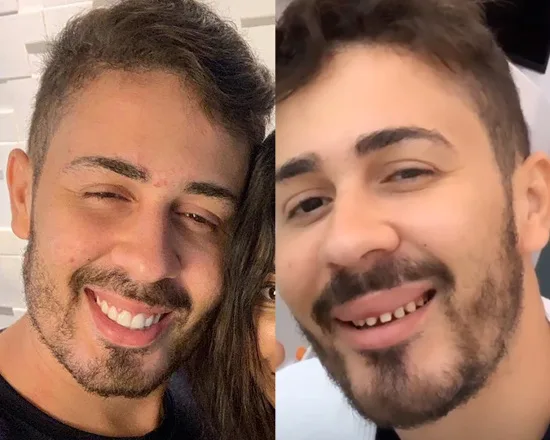 Carlinhos Maia surpreende ao mostrar o sorriso natural