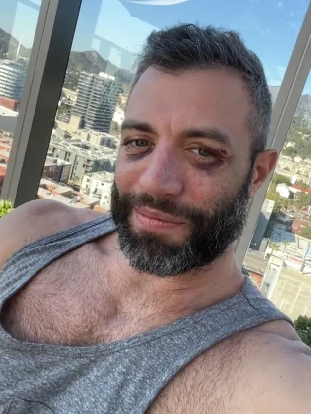 Ator pornô gay é espancado por seis homens