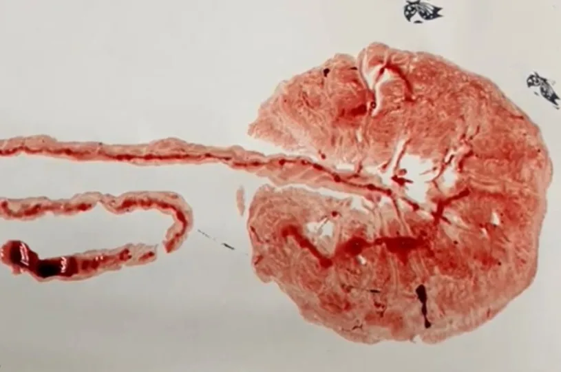 VÍDEO | Placenta se transforma em obra de arte para presentear mães em hospital