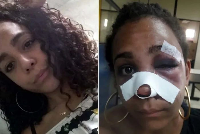 Balconista é agredida pelo ex na frente da filha de dois anos