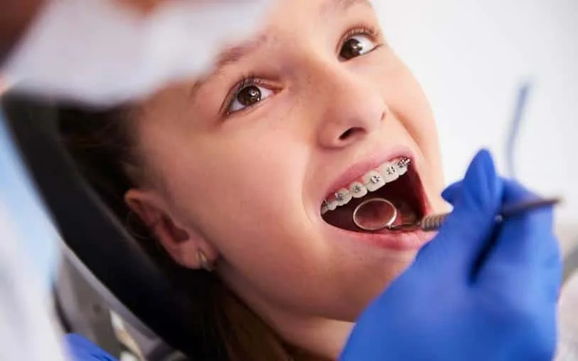 Quais são os cinco sinais de que seu filho precisa usar aparelho nos dentes?