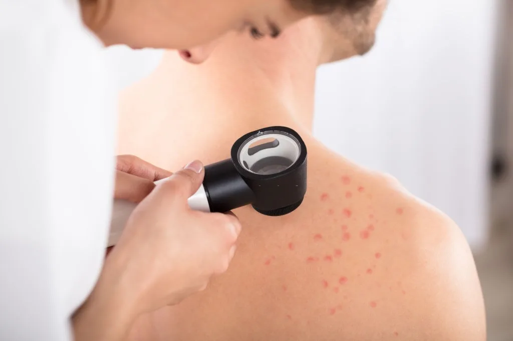 Close-up Of A Female Doctor Examining Skin Of Patient With Dermatoscope