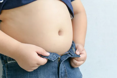 The size of stomach of children with overweight.