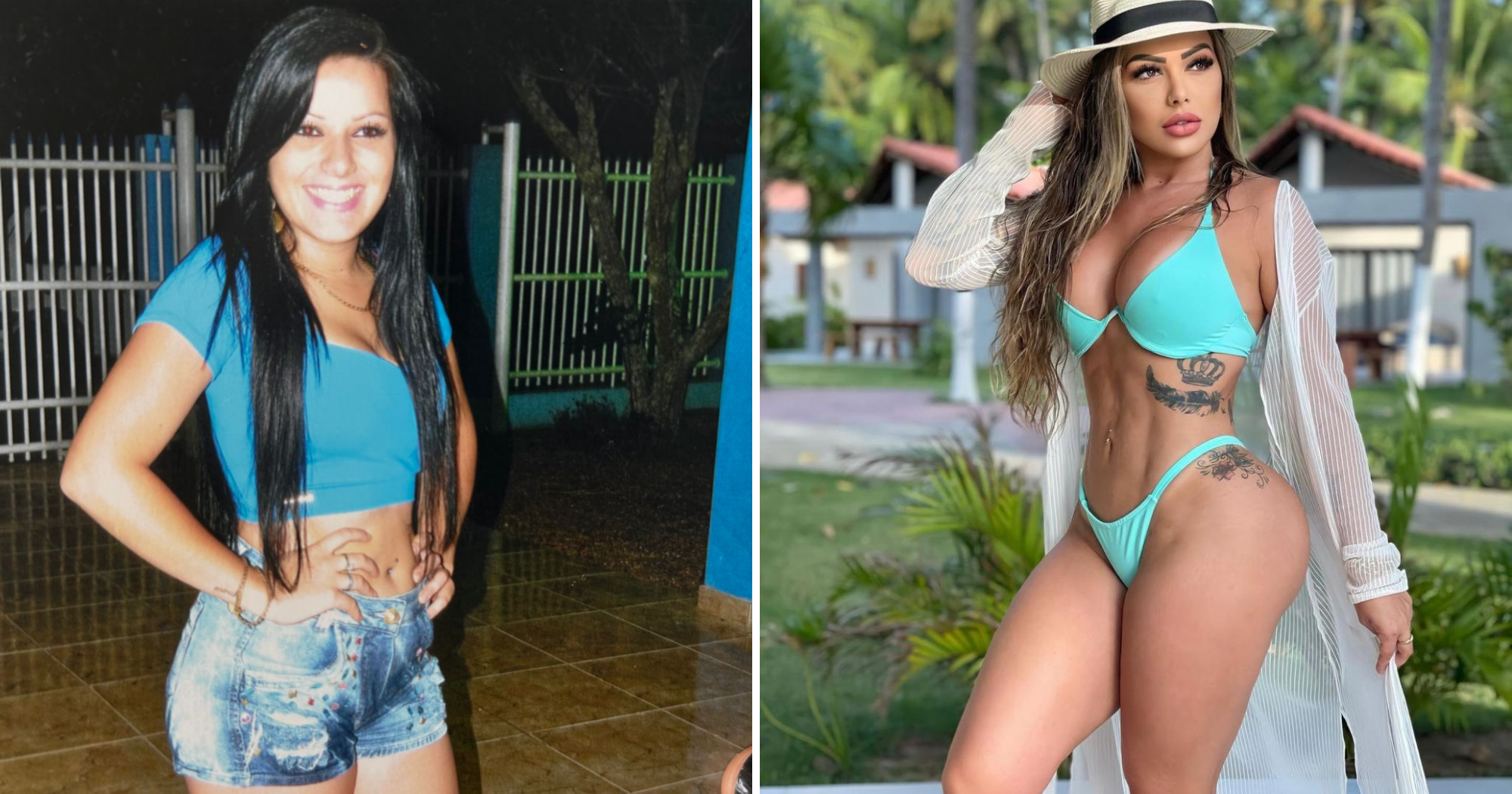 Após 8 lipos e 12 plásticas, antes e depois de influencer choca: "Mais de R$ 300 mil"