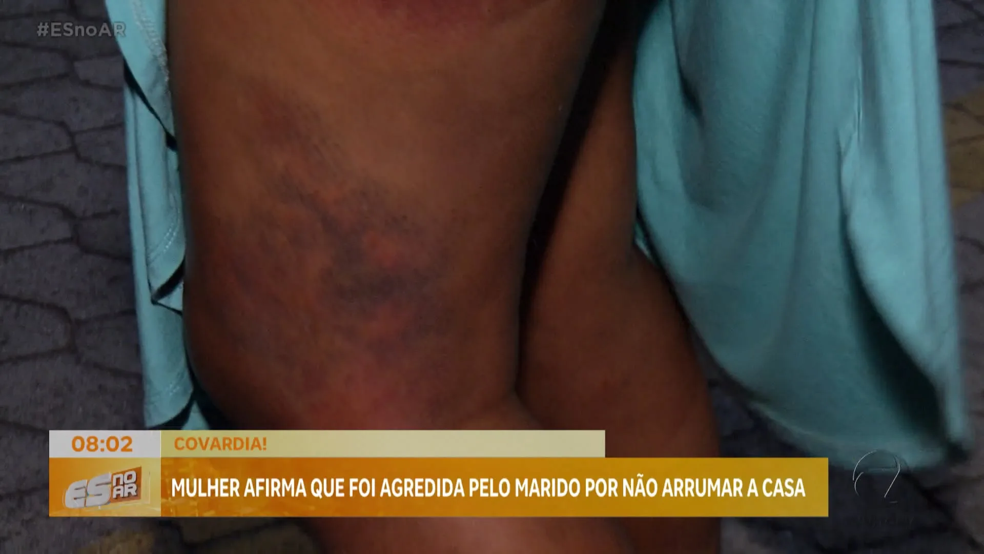 Mulher afirma que foi agredida pelo marido por não arrumar a casa