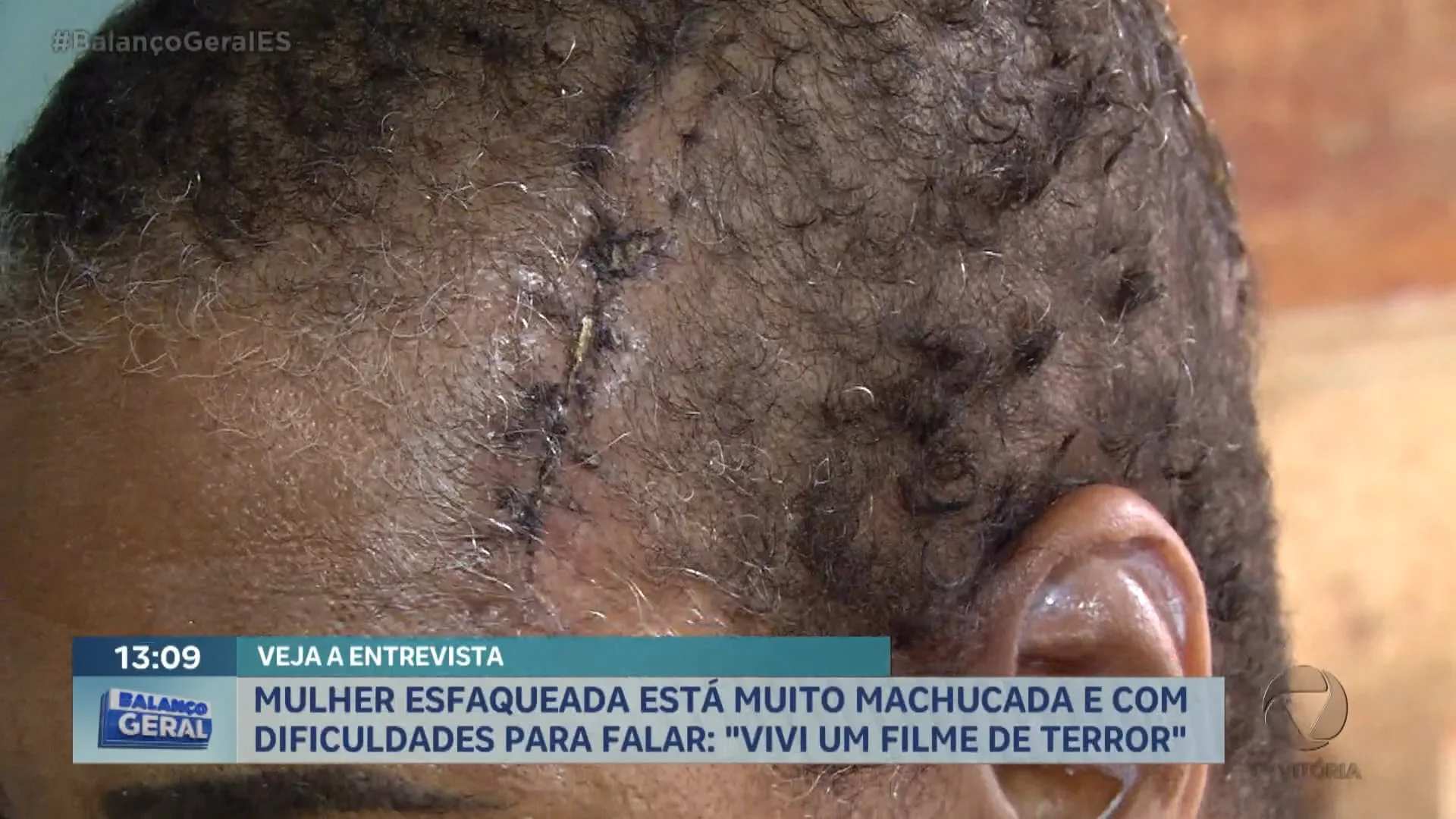 Mulher esfaqueada esá muito machucada e assustada