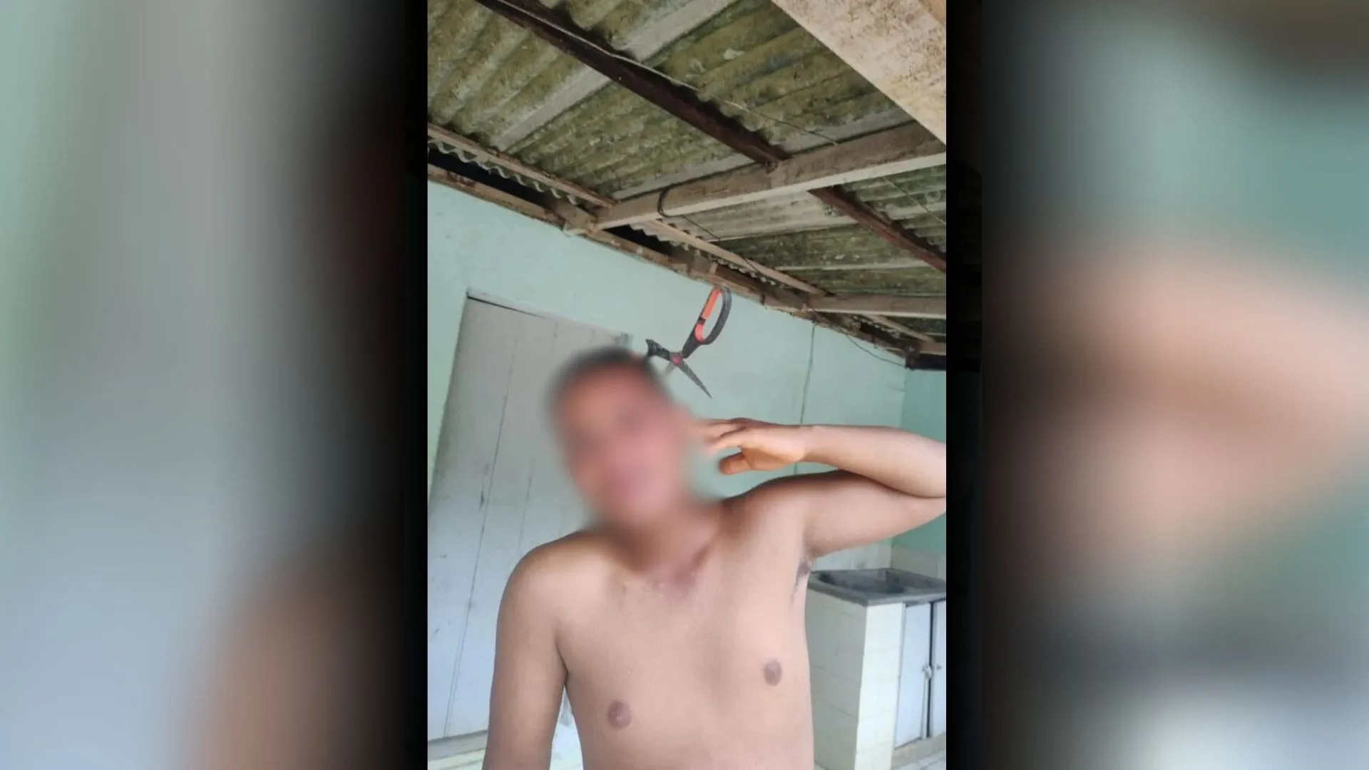 Homem tem tesoura fincada na cabeça após briga com cunhada de 13 anos