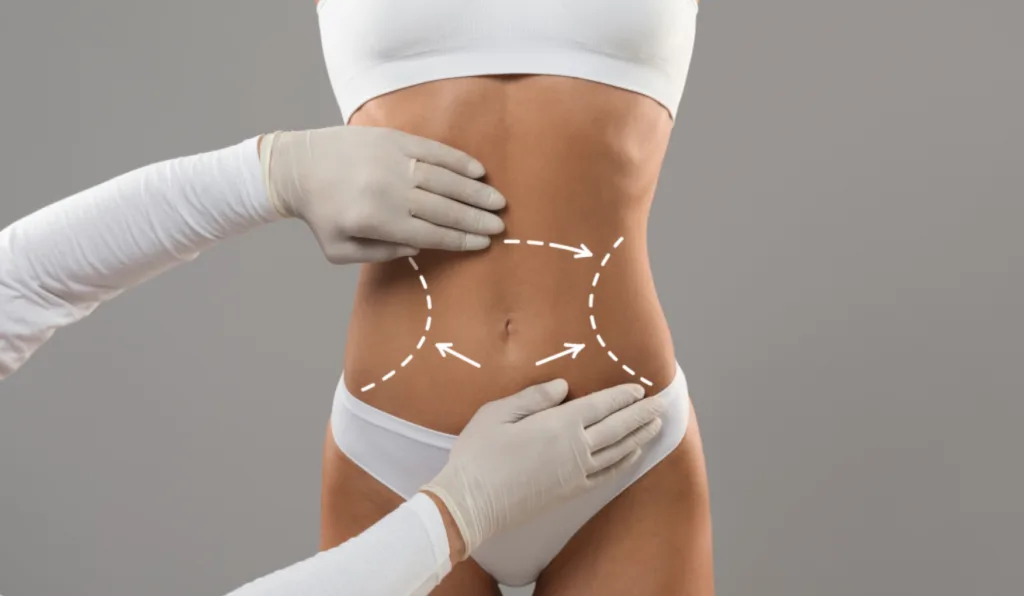 Lipo enzimática/Reprodução