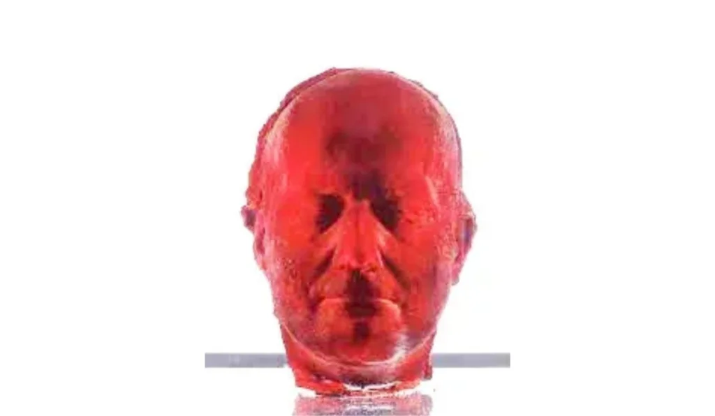 “Self”, de Marc Quinn, 1991. Foto: Reprodução “Self”, de Marc Quinn, 1991. Foto: Reprodução