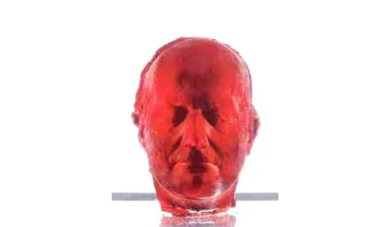 “Self”, de Marc Quinn, 1991. Foto: Reprodução