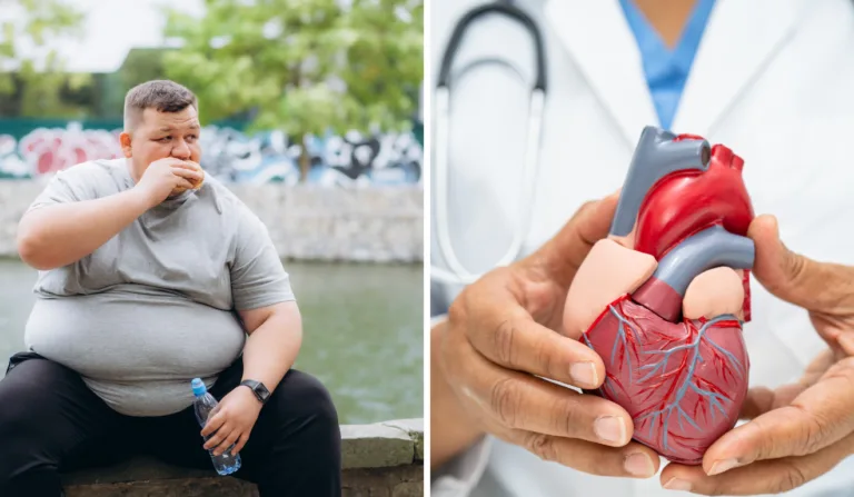 A obesidade é um fator de risco para diversas doenças crônicas/Foto: Canva