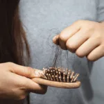 Sintomas da queda de cabelo/Canva