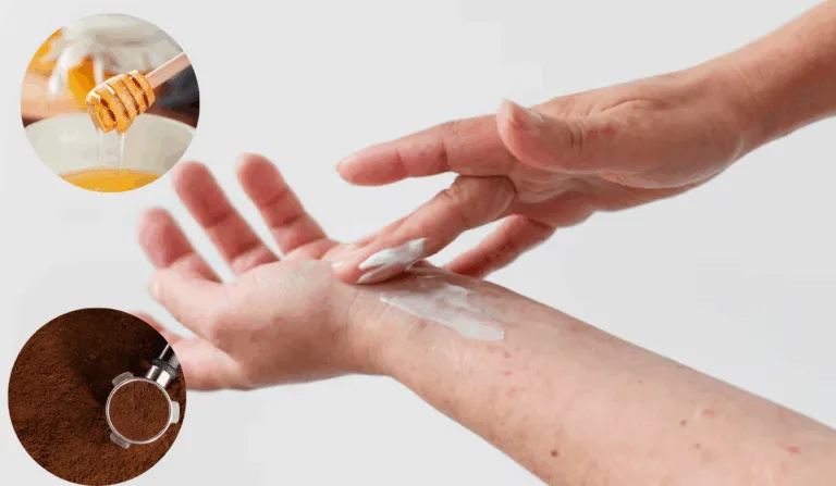 Receita natural para ressecamento (Foto: freepik)