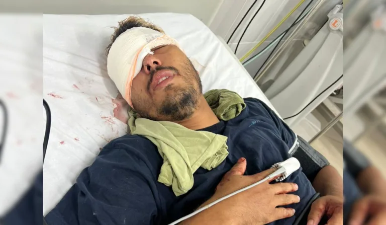 Empresário perdeu um olho após ser atingido por bala de borracha da PM. Foto: Reprodução/ TV Vitória