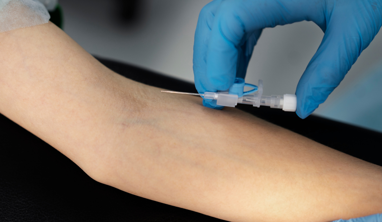 Exame de sangue (Foto: Freepik)