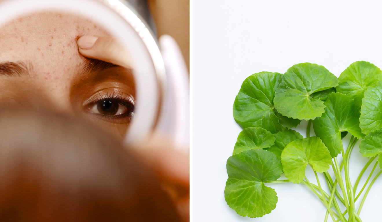 Planta ajuda a reduzir as olheiras e rugas da pele/Reprodução