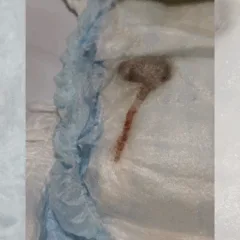 Rato encontrado em fralda de bebê no Rio