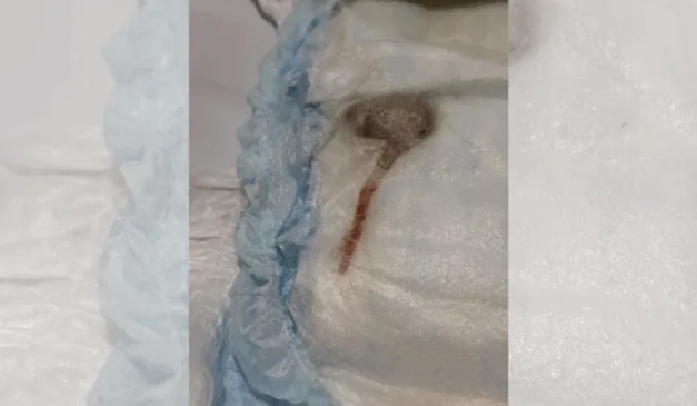 Rato encontrado em fralda de bebê no Rio